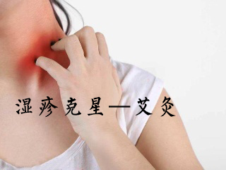 蕲艾穴位灸治——湿疹